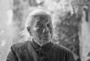 RF美顔器を使ったシワ改善の効果とは？